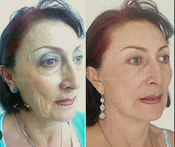 Serum Facial BIOESTIMULADOR y ANTIENVEJECIMIENTO 🌿🌿
