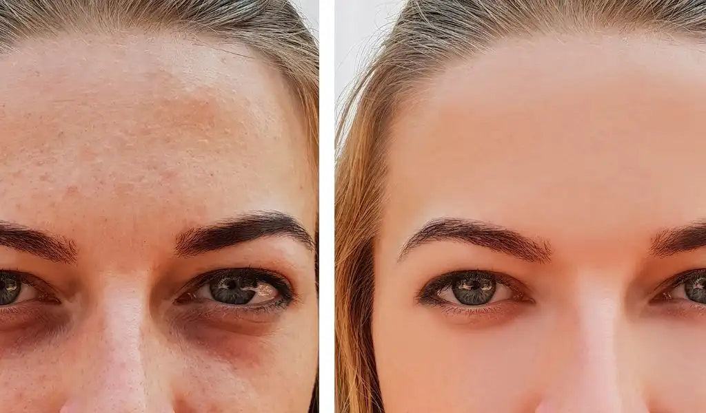 Corrector de ojeras en barra - Maquillaje facial multifunción.  🌟🌟